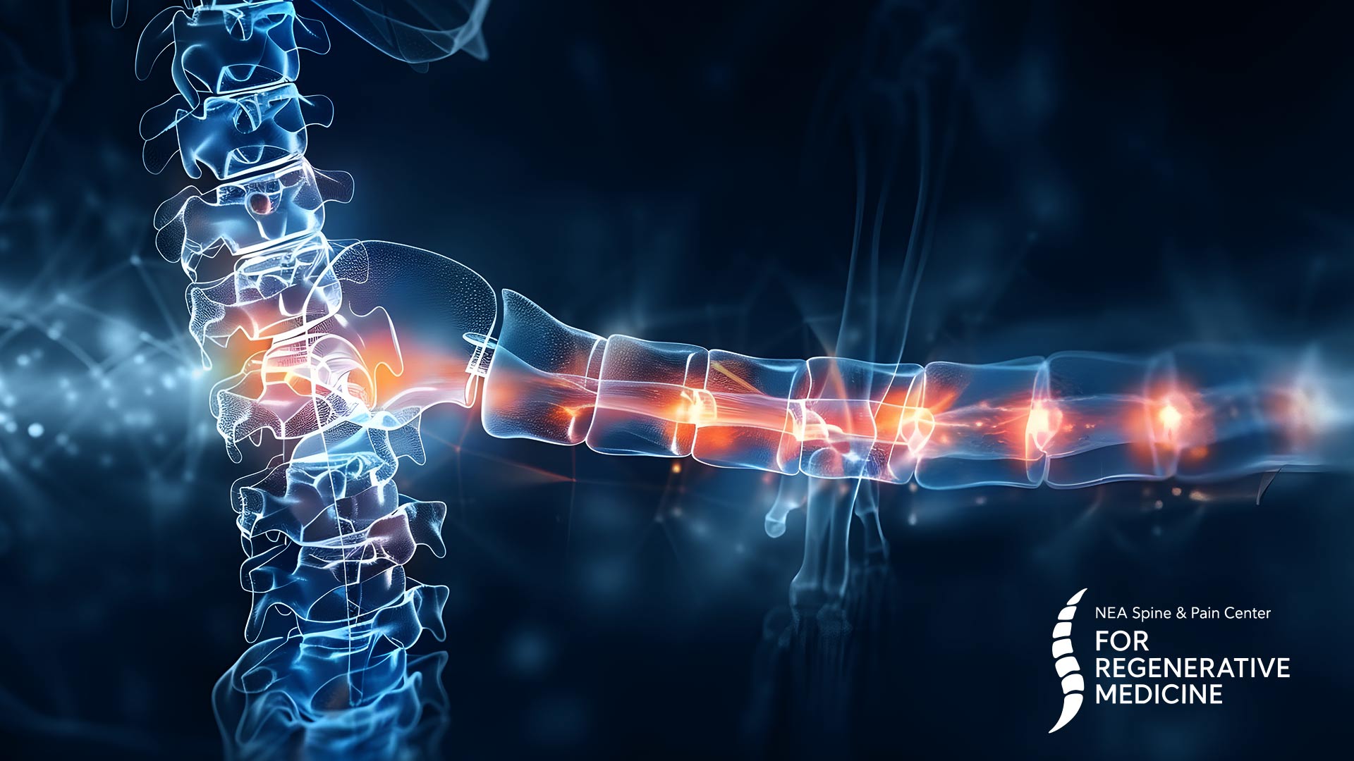 SCS-Vs-DRG-Stimulation