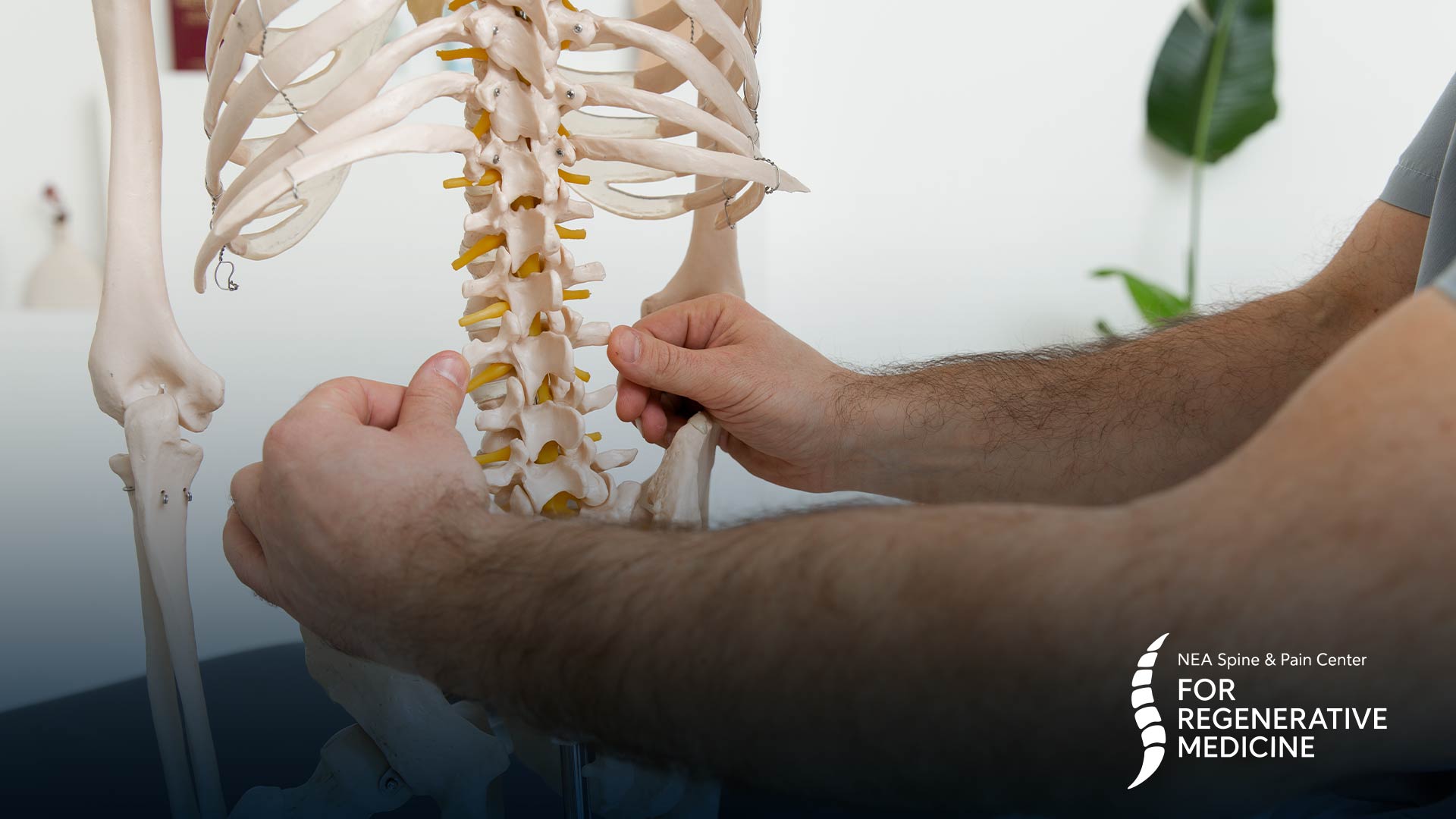 Dorsal-Root-Ganglion-(DRG)-stimulation