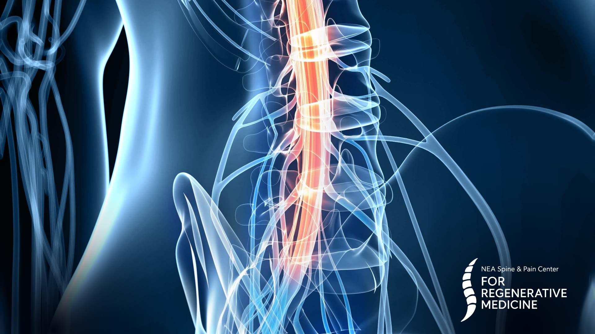 Dorsal-Root-Ganglion-(DRG)-stimulation